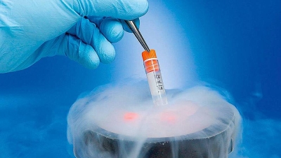 Homens recorrem ao congelamento de sêmen para adiar paternidade