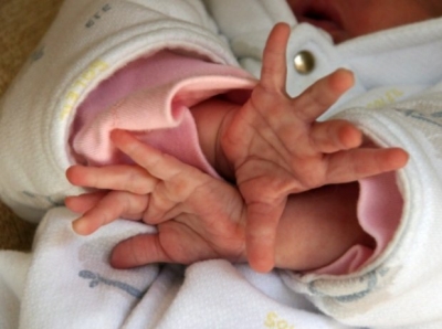 Bebê de 6 meses é espancado até a morte por mãe de 15 anos