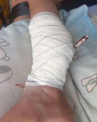 Criança cai de telhado e tem perna perfurada por lança de portão de ferro