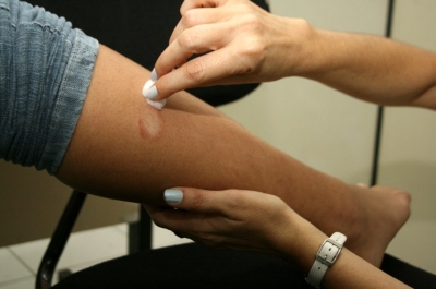 Hanseníase é tema de campanha para diagnóstico e orientação em Marília