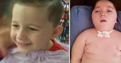 Pai faz campanha na web para pagar tratamento de menino com síndrome rara