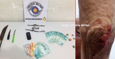 Idoso é torturado durante assalto, mas consegue pedir socorro. Casal acaba preso