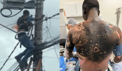 Homem que levou choque de 13 mil volts tem alta após 5 meses e desabafa: 