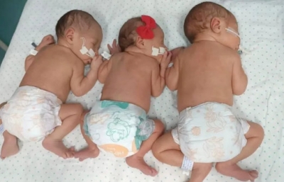 Em tratamento de câncer e prestes a retirar uma mama, mulher engravida e dá à luz trigêmeos 