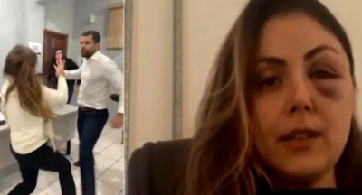 Procurador que espancou procuradora-geral durante expediente é preso em São Paulo