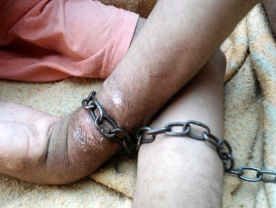 Mãe busca ajuda para filho que vive acorrentado há 13 anos