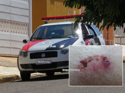 Homem surta e morde policial em Marília