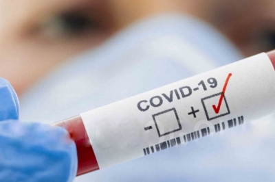 Covid-19: Saúde confirma mais duas mortes em Marília