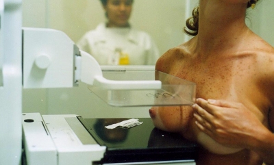 Mamografias no País crescem 37% em seis anos
