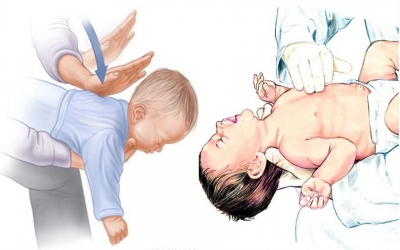 USP lança cartilha com cuidados em caso de engasgo de criança