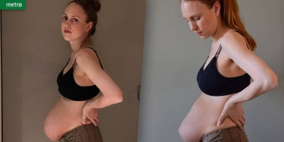 Mãe de trigêmeos mostra os efeitos reais da maternidade