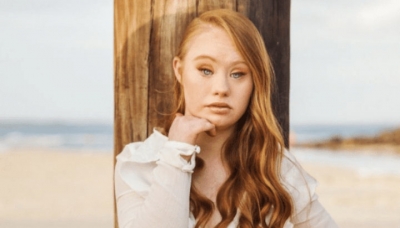 Modelo com síndrome de Down perdeu 25 kg, hoje ela mostra sua aparência espetacular