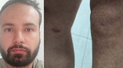 Pai que acompanhava filha à distância é confundido com estuprador e espancado