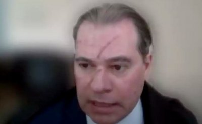 Ministro do STF mariliense surpreende ao aparecer com hematomas no rosto