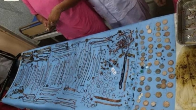 Médicos retiram 220 peças de joias de estômago de doente compulsiva