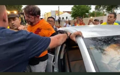 Senador Cid Gomes é baleado e está na UTI