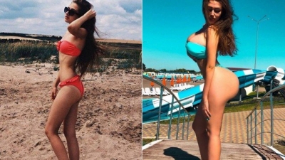 Russa comparada a Kim Kardashian nega ter feito cirurgia apesar de transformação impressionante