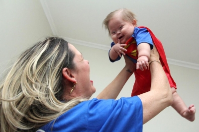 Bebê com síndrome de Down testa positivo para coronavírus e está internado em Bauru
