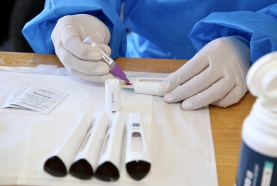 Governo amplia monitoramento em rede do coronavírus para 120 cidades