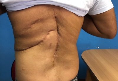 Erro médico: Governo do RJ é condenado a pagar R$ 150 mil de indenização