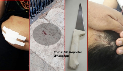 Violência em frente a EMEI assusta pais e crianças. Mulher é esfaqueada por rival