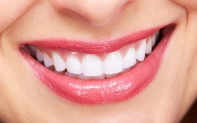 Dicas para manter os dentes bonitos e saudáveis
