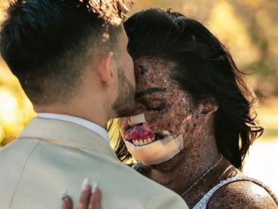 Mulher com doença rara e que já passou por mais de 100 cirurgias é exemplo de fé e esperança