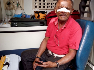 Motociclista fica ferido com linha de cerol