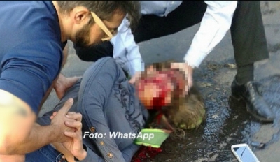 Ciclista fica gravemente ferida em acidente