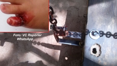 Criança pode perder o dedo do pé ao sofrer acidente em brinquedo no Bosque 