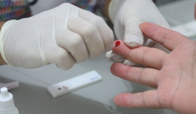 “Fique Sabendo”: mais de 1.400 testes e 30 casos positivos