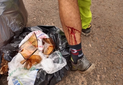 Coletor sofre corte na perna com vidro quebrado dentro de saco de lixo