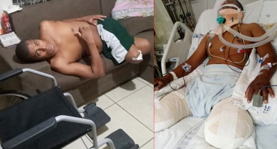 Caminhoneiro mariliense que sofreu grave acidente vive mais um drama