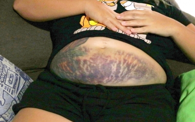 Grávida perde bebê após acidente e acusa hospital de negligência