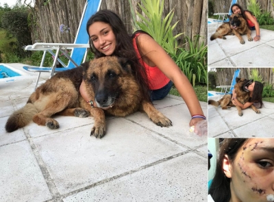 Jovem é atacada por cão durante sessão fotográfica