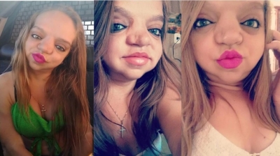 Mulher com síndrome rara viraliza nas redes sociais: 