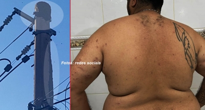 Novo ataque de abelhas interrompe atendimento em UBS da zona Sul em Marília