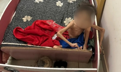 Menino de 7 anos é encontrado abandonado e desnutrido. Pais são presos