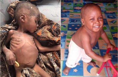 Menino desnutrido é resgatado, tratado e se recupera