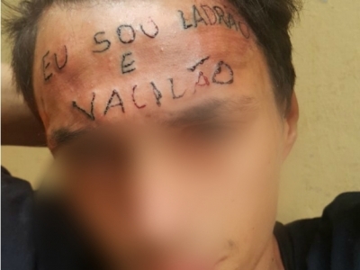 Vaquinha virtual pagará remoção de tatuagem