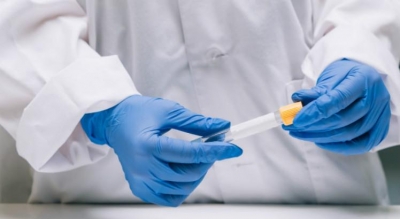 Arenavírus: caso de doença rara é registrado no Estado