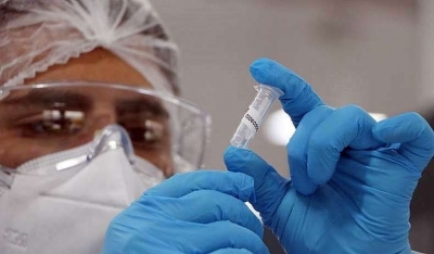 Casos de Síndrome Respiratória Grave sobem 135% em todo país