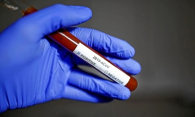 Adolescente e mulher são as novas vítimas da Covid-19 em Marília