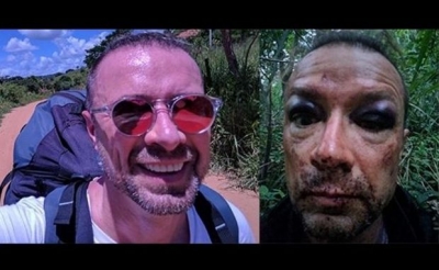 Homem despenca de parapente, sobrevive e tira selfie