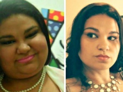 Sem cirurgia, ela emagreceu 47 kilos