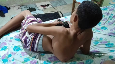 Adolescente precisa de cirurgia que custa quase R$ 1 milhão e família pede ajuda