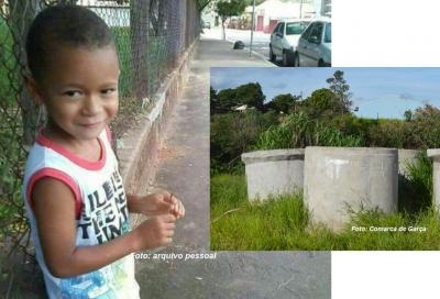 Morre menino que sofreu queimaduras em 90% do corpo 