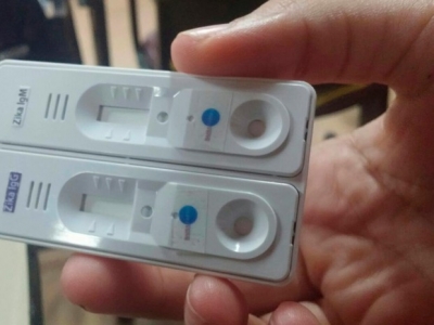Teste rápido nacional da zika dará resultado em 20 minutos
