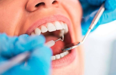 Câncer de boca deve atingir 14,7 mil novos casos no país este ano