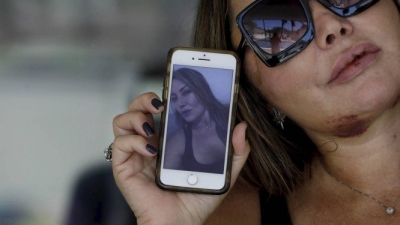 Paisagista agredida por quatro horas deve depor nesta segunda-feira